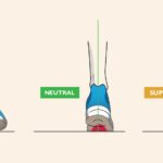 Foot pronation and running shoe assessment